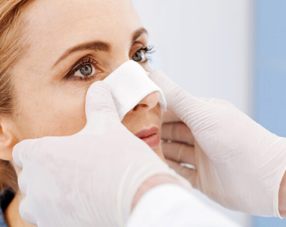 Chirurgia del naso: quali sono le diverse tipologie di intervento?